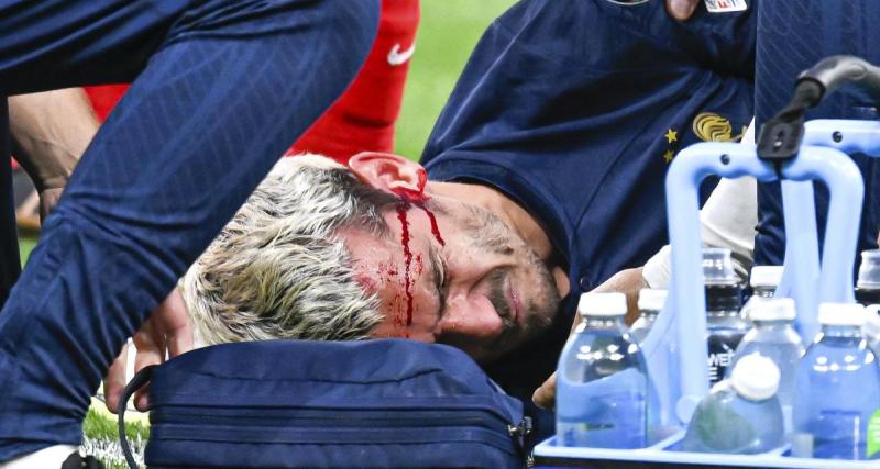  - Equipe de France : Griezmann garde des séquelles de son match face à la Grèce