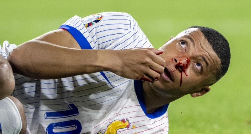  - Equipe de France : la FFF confirme pour Mbappé et son nez, le capitaine des Bleus manie l'humour !