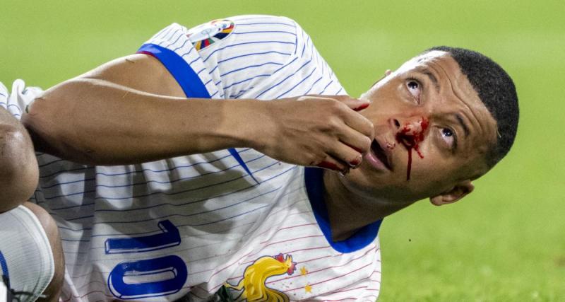  - Équipe de France : quand Mbappé ironise sur sa blessure au nez