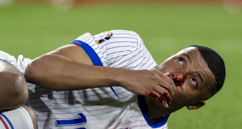  - Équipe de France : le Real Madrid inquiet pour Kylian Mbappé