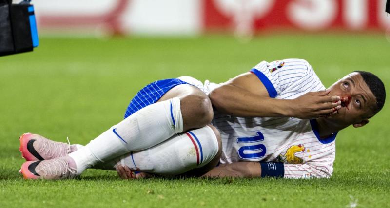  - Equipe de France : la souffrance terrible de Mbappé dans le vestiaire après sa fracture du nez