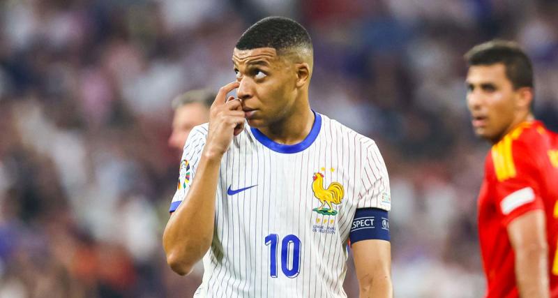  - Real Madrid : grande nouvelle pour le nez de Mbappé !