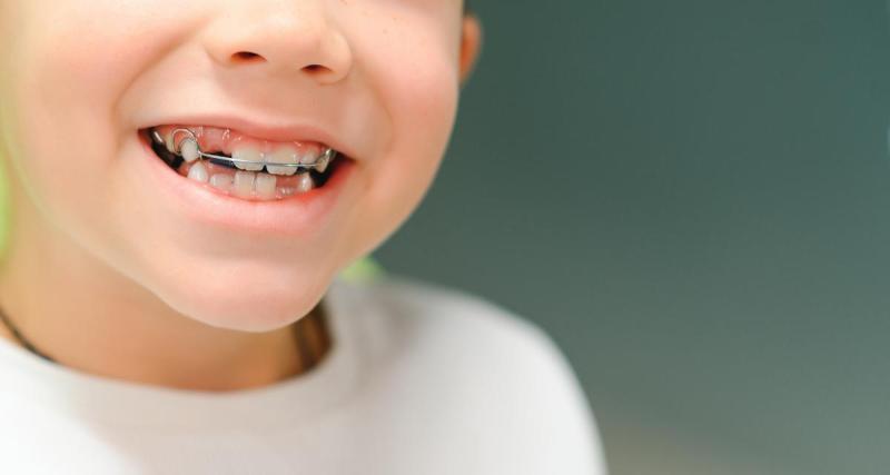  - Orthodontie chez les enfants : combien rembourse la Sécurité sociale et que couvre votre mutuelle 