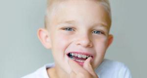 À quel âge mon enfant peut-il consulter un orthodontiste pour la première fois ? Tout ce que vous devez savoir 