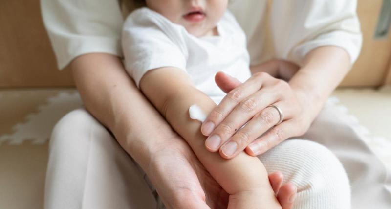  - Votre enfant a une peau atopique : Tout ce que vous devez savoir pour comprendre et l’aider au quotidien