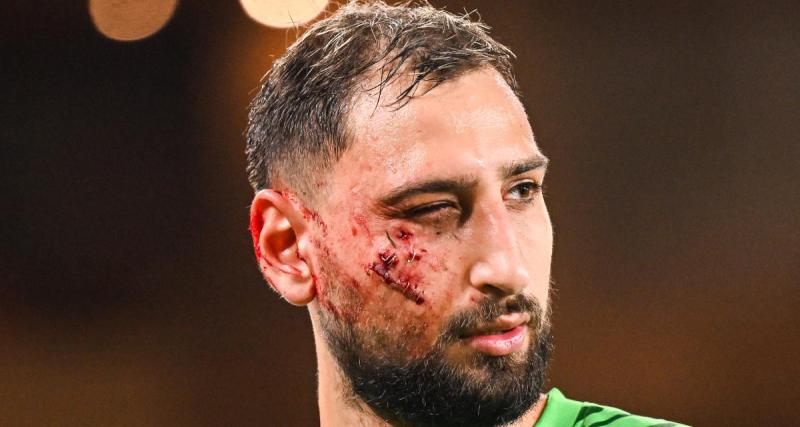  - Monaco - PSG : Donnarumma a reçu des agrafes sur la pelouse !