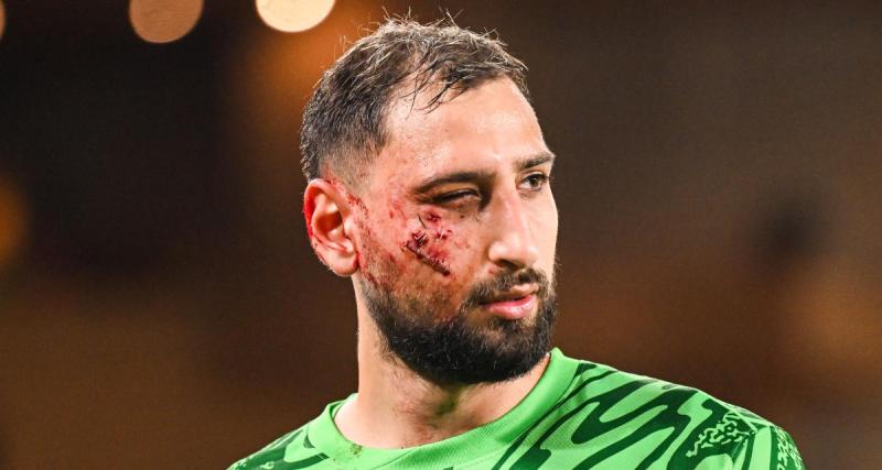  - Monaco - PSG : traumastime facial pour Donnarumma