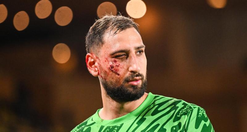  - PSG : le premier constat tombe pour Donnarumma après sa blessure impressionnante au visage 