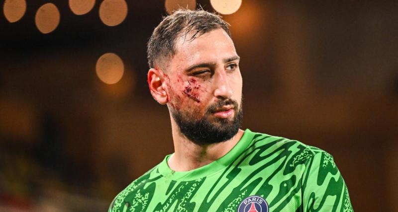  - PSG : la cicatrice impressionnante de Donnarumma au visage