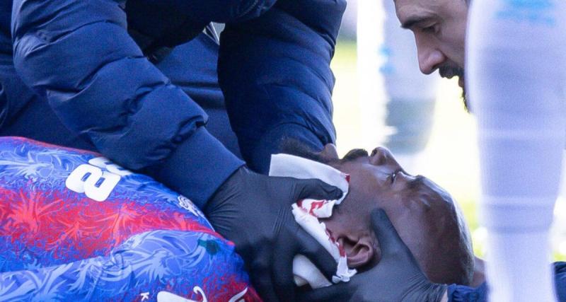  - L'impresionnnant bandage de Mateta après sa terrible blessure à l'oreille