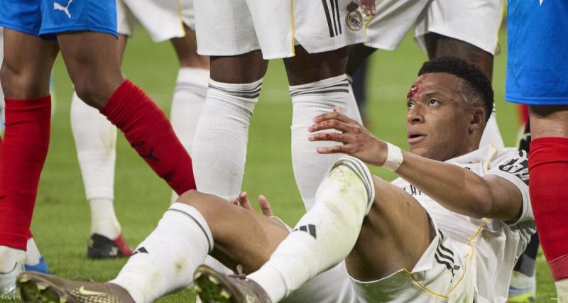  - Étranger : Kylian Mbappé (Real Madrid) va jouer avec un gros pansement contre le Bayern Munich
