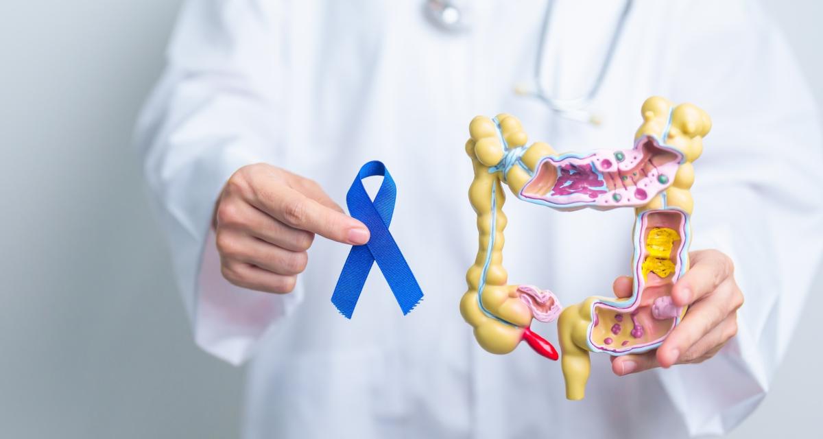 Cancer colorectal : à 50 ans, offrez-vous le cadeau qui pourrait sauver votre vie